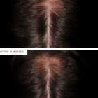Nutrafol Men (3 Month Supply) Before and After Image